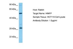 HINFP Rabbit anti-Human, Polyclonal, Novus Biologicals 0.1ml; Unconjugated:Antibodies,